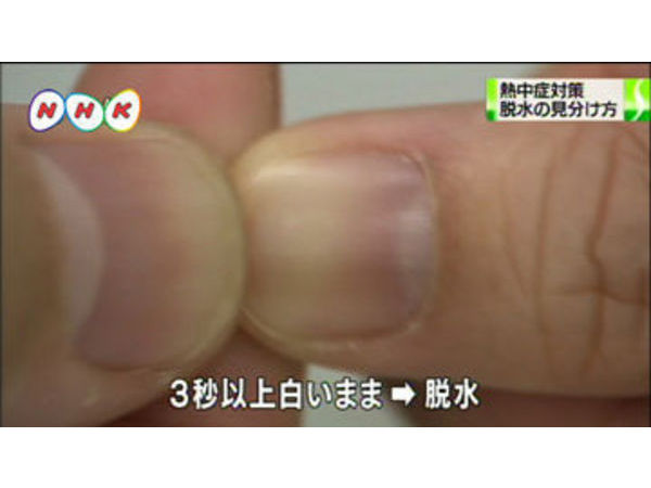 熱中症予防